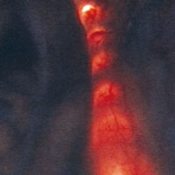 Одно- и двухпросветный мочеточниковый катетер Bush с подсветкой