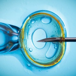 Вспомогательные репродуктивные технологии